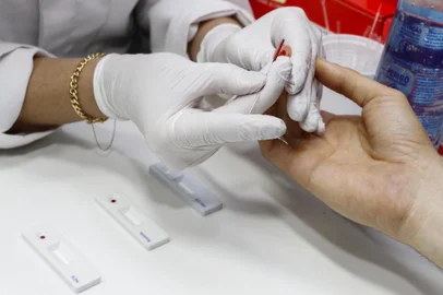 SMS disponibiliza testes rápidos para detectar os vírus HIV/Aids, sífilis e hepatite C