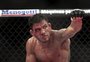 Rafael dos Anjos quer disputar o cinturão: "Mais do que merecido"