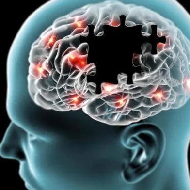Medicamentos utilizados para tratar o diabetes também podem ser usados para tratar a doença de Alzheimer, e vice-versa, de acordo com um estudo recente da Universidade de Aberdeen, na Escócia.Esse é também o primeiro estudo desse tipo que mostra que a doença de Alzheimer pode levar ao diabetes. Até agora, acreditava-se que pessoas obesas desenvolvem diabetes tipo 2 e, então, estariam mais propensas a desenvolver demência. Quer dizer, que o diabetes começava como um defeito no pâncreas ou por causa de uma dieta muito rica em gordura e açúcar. Nesse estudo mostrou-se que as alterações no cérebro causadas pelo Alzheimer podem, igualmente, levar ao desenvolvimento de um diabetes muito severo.l Mudando conceitosNo artigo, publicado no jornal Diabetologia ¿ o jornal da Associação Europeia para o Estudo do Diabetes ¿ os pesquisadores desenvolveram um modelo de Doença de Alzheimer e encontraram que um aumento no funcionamento de um gene envolvido na produção de proteínas tóxicas no cérebro, não somente levava ao sintomas típicos do Alzheimer, mas também ao desenvolvimento das complicações do diabetes.