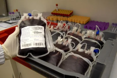  JARAGUÁ DO SUL, SC, BRASIL, 20-08-2013: Queda na doação de sangue em Jaraguá do Sul. (FOTO: GERMANO RORATO/AGÊNCIA RBS, GERAL)