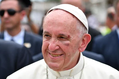  

Pope Francis, showing a bruise around his left eye and eyebrow caused by an accidental hit against the popemobile's window glass while visiting the old sector of Cartagena,Colombia, is greeted by faithful on September 10, 2017.
Nearly 1.3 million worshippers flocked to a mass by Pope Francis on Saturday in Medellin, the Colombian city known as the stronghold of the late drug lord Pablo Escobar. / AFP PHOTO / Alberto PIZZOLI

Editoria: REL
Local: Cartagena
Indexador: ALBERTO PIZZOLI
Secao: religious leader
Fonte: AFP
Fotógrafo: STF