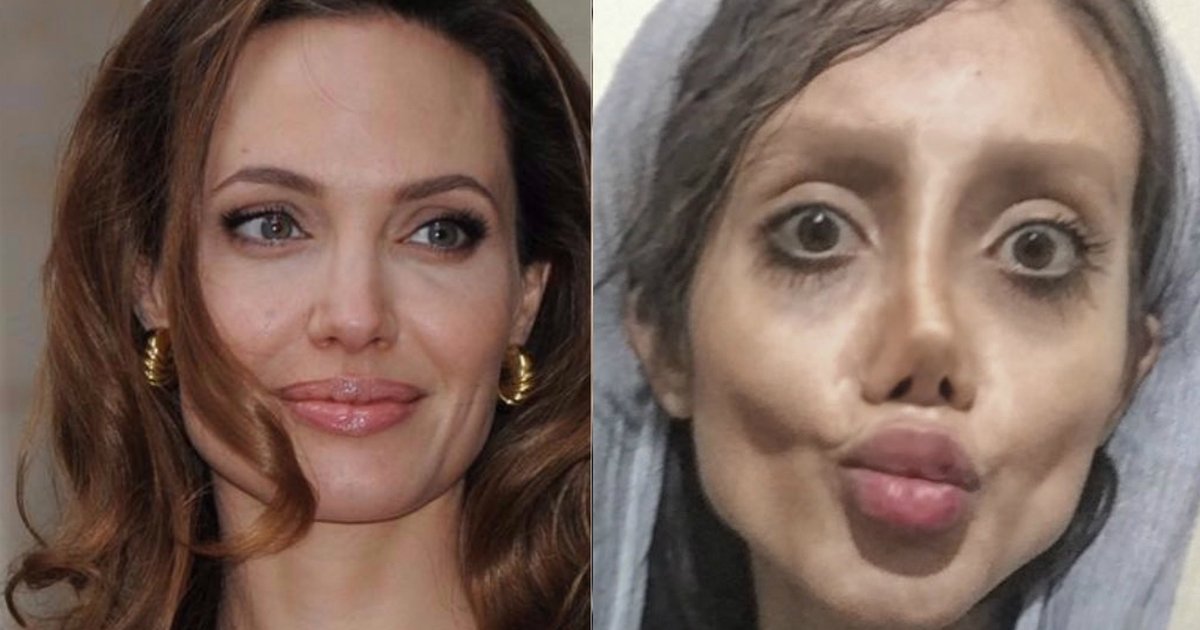 Операции быть похожей. Анджелина Джоли 50 операций. Анджелина Джоли операции пластические 50. Сахар табар и Анджелина Джоли. Анджелина Джоли пластические операции.
