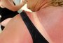 Filtro solar em cápsulas? Conheça os produtos que protegem a pele do sol