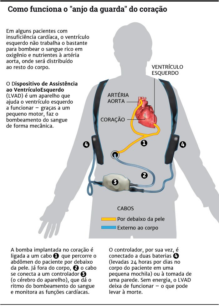 Cirurgia inovadora devolve qualidade de vida a doentes cardíacos