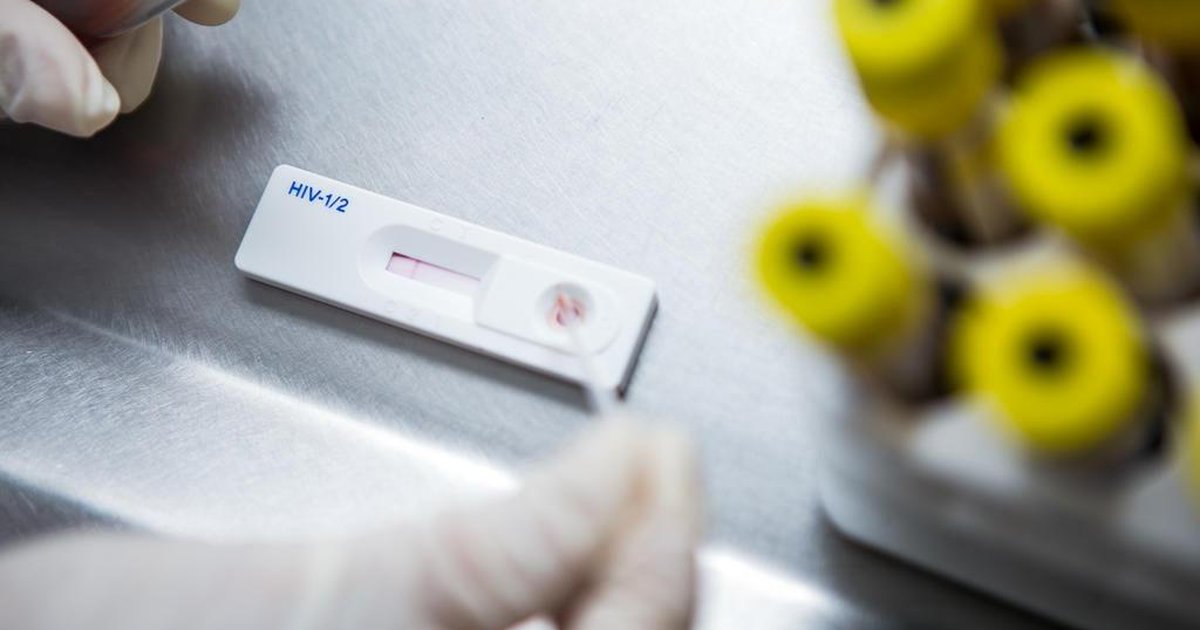 Resultado de imagem para Vacina contra HIV serÃ¡ testada pela primeira vez no Brasil