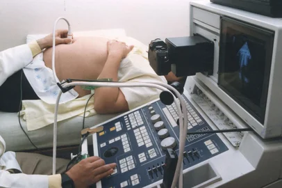 Ecografia para gestantes#PÁGINA:18#PASTA: 048385 Fotógrafo: Não se Aplica