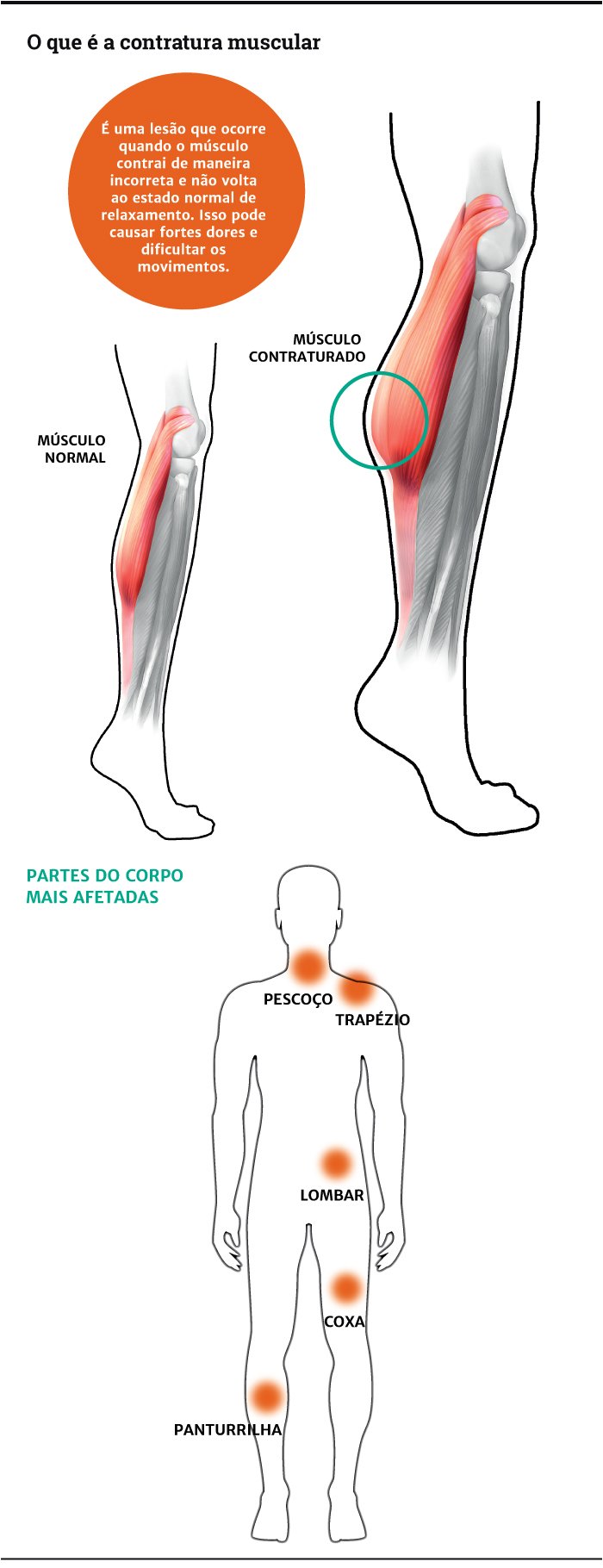 Comum para é um tratamento lesões musculares