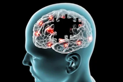 Uma ligação única entre diabetes e Alzheimer, que fornece mais evidências de que uma doença que tira a memória da pessoas pode estar relacionada a taxas elevadas de açúcar no sangue, foi descoberta por pesquisadores da Escola de Medicina da Universidade Washington em St. Louis, nos Estados Unidos. O estudo foi publicado ontem no Journal of Clinical Investigation.