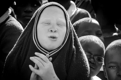 CAXIAS DO SUL, RS, BRASIL, 04/11/2018. Exposição ¿Toda manhã na África¿, do fotógrafo Javier Paquito Herrera, estará no Margs a partir 05/10. A mostra dá sequência à seleção dos trabalhos vencedores no Concurso de Fotografias da AAMARGS - 2018 e ficará aberta até 31 de dezembro. A exposição apresenta com sensibilidade o problema da discriminação dos albinos na África, principalmente em crianças, abandonadas em abrigos, captadas em uma série composta de 16 fotografias no formato 47 x 47 cm. (Javier Paquito Herrera/Divulgação)