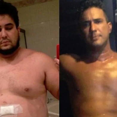 André Marques, bariátrica, antes e depois