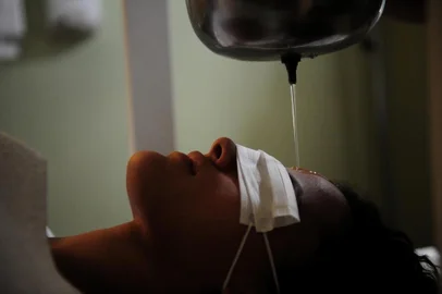  CAXIAS DO SUL, RS, BRASIL, 22/11/2018De origem indiana, o ayurveda é uma terapia benéfica para o tratamento de alergias da primavera. Um dos recursos usados é o shirodhara, no qual o paciente, deitado e com os olhos cobertos por um pano, recebe um fluxo contínuo de um óleo essencial na testa. (Lucas Amorelli/Agência RBS)