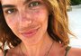 Mariana Goldfarb remove preenchimento facial e desabafa sobre busca pela perfeição