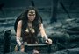 Gal Gadot passou por cirurgia nas costas após filmagens de "Mulher-Maravilha"