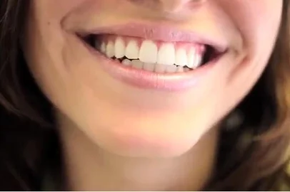 sorrisoImportação Donnahttp://revistadonna.clicrbs.com.br/wp-content/s/2014/11/sor
