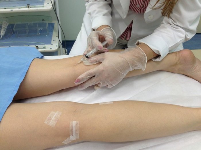 Quanto tempo você pode usar gel de arnica
