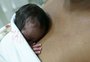 Prática que melhora o tratamento de bebês prematuros completa 40 anos; veja os benefícios