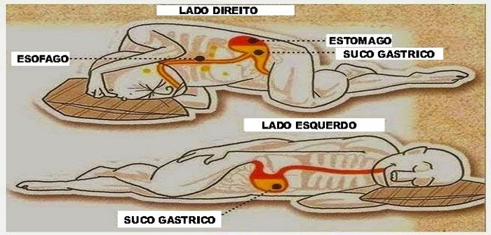 por que meu corpo dói quando dorme