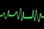 Batimento cardíaco, coração, eletrocardiograma, eletro