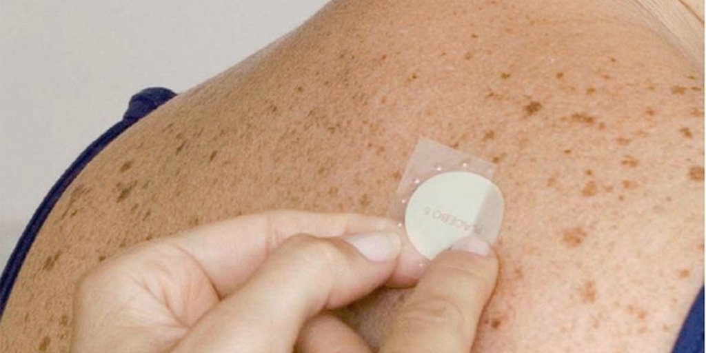 Resultado de imagem para Adesivo para tratamento de Alzheimer jÃ¡ estÃ¡ disponÃ­vel pelo SUS â Parte ll