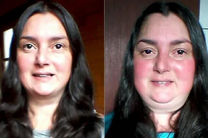 Rifa online arrecada dinheiro para ação judicial que garantirá continuidade do tratamento de Daisy Fortes, portadora da Síndrome de Látex Alimento (SLA)