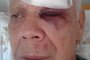 Claudio Antonio Mendes, 71 anos, foi atropelado por patinete elétrica em Porto Alegre.