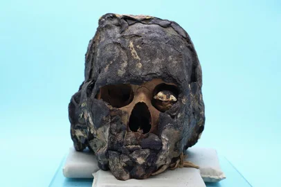  PORTO ALEGRE, RS, BRASIL - Crânio que pertenceu a uma mulher na faixa dos 40 anos, que viveu no Egito no período entre 768-476 a.C, é identificado pelo pós-doutor em História, pesquisador e caçador de relíquias Édison Hüttner (FOTO), também coordenador do Grupo de Estudo Identidades Afro-Egípcias da Pontifícia Universidade Católica do Rio Grande do Sul (Pucrs).Indexador: Jeff Botega