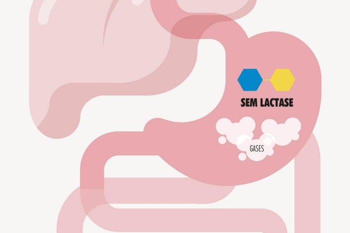 Intolerancia A Lactose Causas E Sintomas Gzh