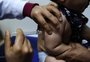 Brasil atinge meta global de vacinação contra o sarampo