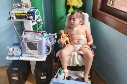 Yasmin Vieira, 03 anos, de Vacaria, foi diagnosticada com Holoprosencefalia, que provoca má formação cerebral, compromete o sistema digestivo e provoca crises convulsivas de difícil controle.A família precisa de ajuda para manter diversos procedimentos, como os tubos de oxigênio, medicamentos e equipamentos para auxiliar a criança.