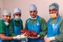 In this handout photograph taken on October 29, 2019 and released by Sir Ganga Ram Hospital on November 25, 2019, hospital staff members pose for photographs as they hold a diseased kidney after a surgery in Sir Ganga Ram Hospital in New Delhi. - Indian surgeons have cut a kidney weighing the same as two new-born babies out of a man with a life-threatening genetic condition, a surgeon said on November 25. The 7.4 kilogramme (16.3 pound) kidney is one of the biggest ever removed in an operation. (Photo by Handout / Sir Ganga Ram Hospital / AFP) / RESTRICTED TO EDITORIAL USE - MANDATORY CREDIT AFP PHOTO / Sir Ganga Ram Hospital - NO MARKETING NO ADVERTISING CAMPAIGNS - DISTRIBUTED AS A SERVICE TO CLIENTS --- NO ARCHIVE ---