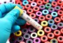 Cientistas testam vacina contra o HIV com tecnologia semelhante à da AstraZeneca para a covid-19