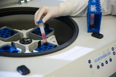Importante reduto em pesquisa sobre a doença, o Laboratório de Pesquisa em HIV/AIDS da Universidade de Caxias do Sul (UCS) é responsável por fomentar ao país estatísticas sobre o avanço da doença e características dos públicos que contraem e convivem com o HIV. A partir do próximo ano, o laboratório deve aprofundar pesquisas desenvolvidas por meio de parcerias com universidades, instituições governamentais, privadas e agências de fomento nacionais e internacionais _ por isso, uma ampliação do laboratório é estudada pela UCS. Inaugurado em 2012, a equipe já conduziu 23 projetos de pesquisa, envolvendo mais de 100 mil participantes.<!-- NICAID(13862797) -->