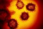  This handout illustration image obtained February 27, 2020 courtesy of the National Institutes of Health shows a transmission electron microscopic image  that shows SARS-CoV-2also known as 2019-nCoV, the virus that causes COVID-19, isolated from a patient in the US, emerging from the surface of cells cultured in the lab. - President Donald Trump has played down fears of a major coronavirus outbreak in the United States, even as infections ricochet around the world, prompting a ban on pilgrims to Saudi Arabia. China is no longer the only breeding ground for the deadly virus as countries fret over possible contagion coming from other hotbeds of infection, including Iran, South Korea and Italy. There are now more daily cases being recorded outside China than inside the country, where the virus first emerged in December, according to the World Health Organization. (Photo by Handout / National Institutes of Health / AFP) / RESTRICTED TO EDITORIAL USE - MANDATORY CREDIT AFP PHOTO /NATIONAL INSTITUTES OF HEALTH/NIAID-RML/HANDOUT  - NO MARKETING - NO ADVERTISING CAMPAIGNS - DISTRIBUTED AS A SERVICE TO CLIENTSEditoria: HTHLocal: WashingtonIndexador: HANDOUTSecao: healthcare policyFonte: National Institutes of HealthFotógrafo: Handout<!-- NICAID(14435483) -->