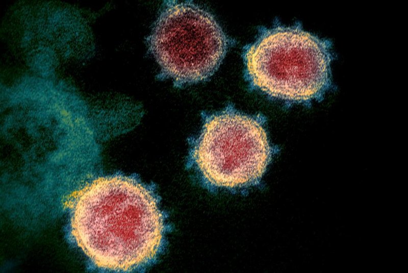  This handout illustration image obtained February 27, 2020 courtesy of the National Institutes of Health shows a transmission electron microscopic image  that shows SARS-CoV-2also known as 2019-nCoV, the virus that causes COVID-19, isolated from a patient in the US, as the Virus particles are shown emerging from the surface of cells cultured in the lab- the spikes on the outer edge of the virus particles give coronaviruses their name, crown-like. - President Donald Trump has played down fears of a major coronavirus outbreak in the United States, even as infections ricochet around the world, prompting a ban on pilgrims to Saudi Arabia. China is no longer the only breeding ground for the deadly virus as countries fret over possible contagion coming from other hotbeds of infection, including Iran, South Korea and Italy. There are now more daily cases being recorded outside China than inside the country, where the virus first emerged in December, according to the World Health Organization. (Photo by Handout / National Institutes of Health / AFP) / RESTRICTED TO EDITORIAL USE - MANDATORY CREDIT AFP PHOTO /NATIONAL INSTITUTES OF HEALTH/NIAID-RML/HANDOUT  - NO MARKETING - NO ADVERTISING CAMPAIGNS - DISTRIBUTED AS A SERVICE TO CLIENTSEditoria: HTHLocal: WashingtonIndexador: HANDOUTSecao: healthcare policyFonte: National Institutes of HealthFotógrafo: Handout<!-- NICAID(14435482) -->