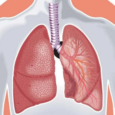 A persistência da tuberculose<!-- NICAID(14017114) -->