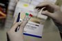  PORTO ALEGRE, RS, BRASIL, 09/03/2020- Exames Coronavirus. Funcionamento dos kit para testes do coronavírus.(FOTOGRAFO: LAURO ALVES / AGENCIA RBS)