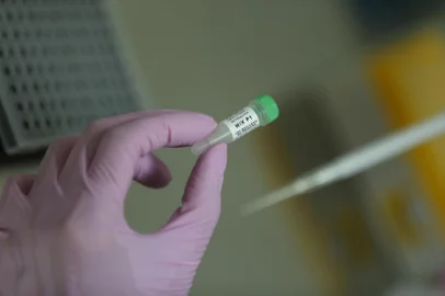  PORTO ALEGRE, RS, BRASIL, 09/03/2020- Exames Coronavirus. Funcionamento dos kit para testes do coronavírus.(FOTOGRAFO: LAURO ALVES / AGENCIA RBS)<!-- NICAID(14445436) -->