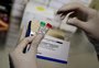 Estado irá distribuir cloroquina a hospitais para tratar casos críticos de coronavírus