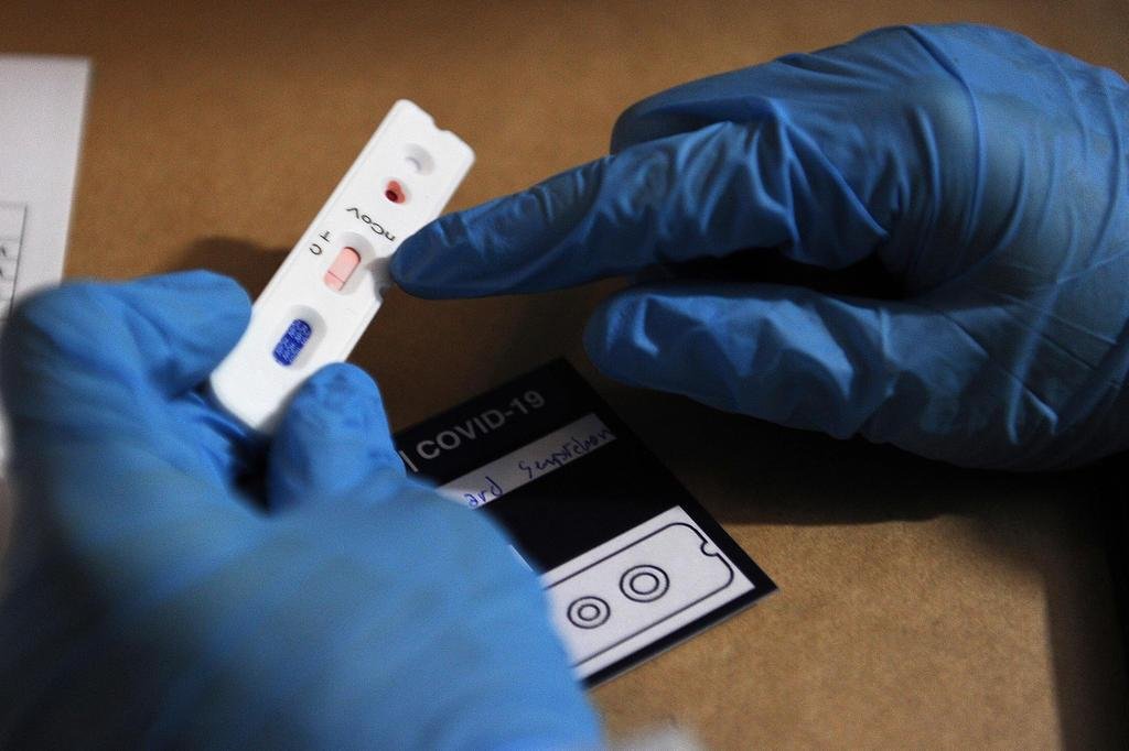 Ampliado para o Brasil, estudo da UFPel aplicará 33 mil testes da covid-19 em 133 municípios