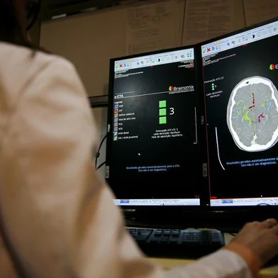  PORTO ALEGRE, RS, BRASIL, 12-01-2019: Para aumentar as chances de pacientes com sintomas de AVC a receberem tratamento de urgência, o Hospital Moinhos de Vento foi o primeiro da América Latina a adquirir um software com soluções integradas para automatização da avaliação da circulação cerebral, angiotomografia e tomografia. Utilizando inteligência artificial, o e-STROKE Suite permite avaliar os casos com maior profundidade. A médica Sheila Martins apresentou o programa para a reportagem (FOTO FÉLIX ZUCCO/AGÊNCIA RBS, Editoria SuaVida).<!-- NICAID(13912502) -->