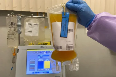 Um homem de 63 anos, que está sob ventilação respiratória mecânica, poderá ser o mais novo paciente recuperado da covid -19 em Caxias do Sul. Um doador de 31 anos concedeu o plasma do seu sangue em procedimento realizado na manhã desta nesta sexta-feira (22) no Hemocentro Regional de Caxias do Sul (Hemocs). Com isso, os dois participam de um tratamento experimental em que os anticorpos do doador, já recuperado do coronavírus, poderão ser transferidos ao doente. A técnica ocorre pela primeira vez no Rio Grande do Sul.<!-- NICAID(14505871) -->