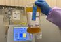 Hospital de Clínicas de Porto Alegre recebe autorização para testar tratamento com plasma de curados