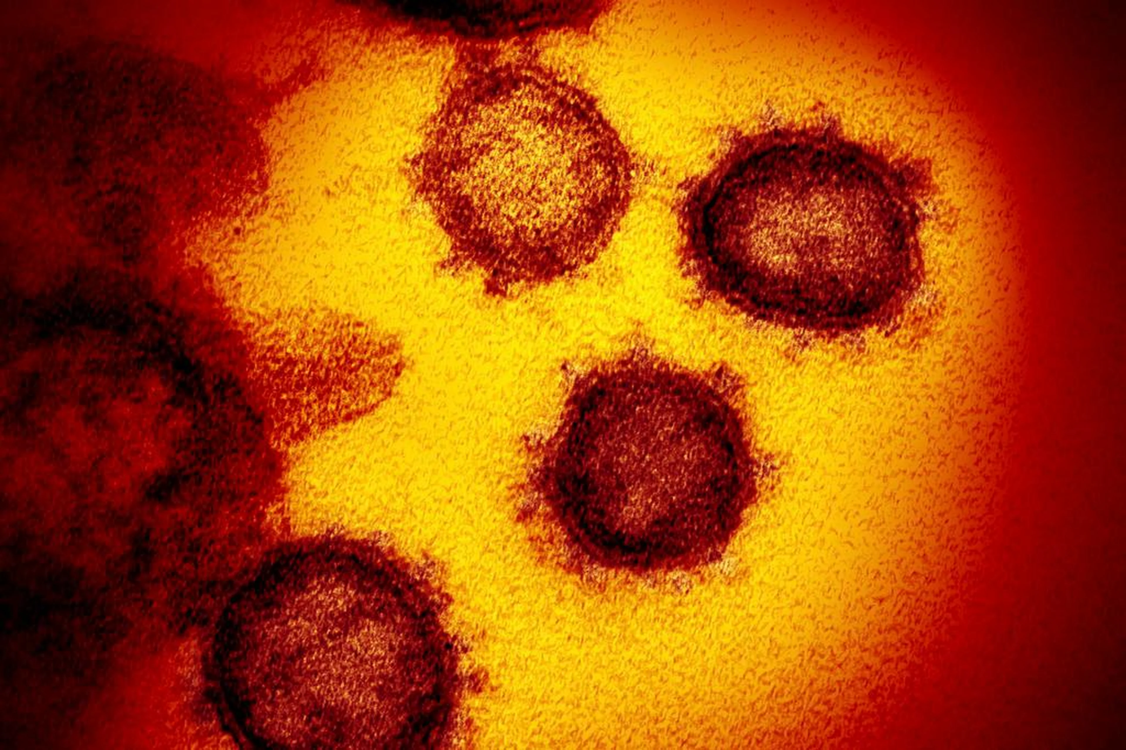 National Institutes of Health/AFP