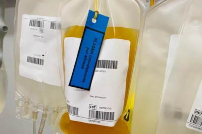 A noite desta terça-feira (26) foi diferente para a equipe médica do Hospital Virvi Ramos e, principalmente, para familiares de um paciente de 63 anos internado na Unidade de Tratamento Intensivo (UTI) com coronavírus. A notícia de que houve compatibilidade com o plasma sanguíneo de um doador mobilizou equipes do Hemocentro Regional de Caxias do Sul (Hemocs) e da instituição de saúde por volta das 20h. Pouco mais de três horas depois, a transfusão já era iniciada.<!-- NICAID(14508864) -->