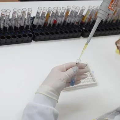 Laboratório do Tacchini passa a disponibilizar teste Elisa para detecção de COVID-19. A partir de segunda-feira, dia 1º, o laboratório do Tacchini passa a disponibilizar para a comunidade um novo teste para detecção de COVID-19. Mais preciso do que os demais, o método Elisa é baseado na reação de antígenos-anticorpos. Tanto a coleta quando a aferição dos resultados são feitos internamente, o que possibilita um valor mais acessível e um resultado mais rápido, até 24 horas após a realização.<!-- NICAID(14512606) -->