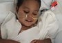 Menino brasileiro com doença rara passa por transplante de cinco órgãos nos Estados Unidos