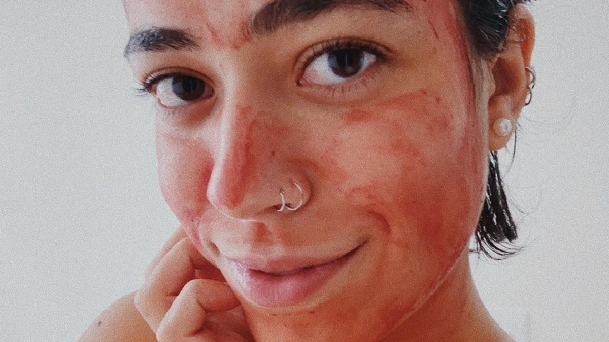 Máscara com sangue menstrual faz bem? Entenda | Donna