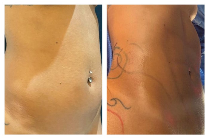 Clínica JK Estética Avançada / Divulgação