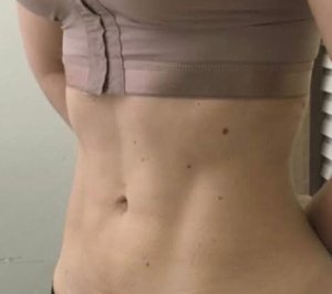 Dr. Flavio Borges Fortes Cirurgia Plástica / Divulgação