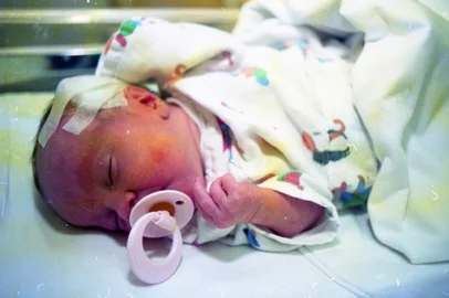  Os batimentos do coração da bebê Marlise Pereira dentro do útero de sua mãe, Isabel Cristina Pereira, de 26 anos,  eram muito lentos.Graças aos avanços da medicina fetal, uma ecocardiografia diagnosticou o problema. A equipe da Unidade de Cardiologia Fetal do Instituto de Cardiologia (IC) decidiu então fazer uma cesariana em Isabel na 34ª semana de gestação para a realizar uma cirurgia de implante de marcapasso definitivo no coração da bebê.A operação aconteceu no dia 11 de dezembro de 1993 e foi um sucesso.-#ENVELOPE: 133823<!-- NICAID(14576510) -->